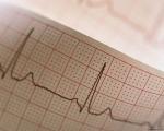 cardiograph.jpg